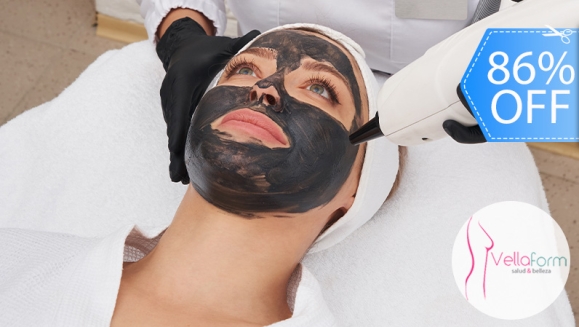 [Image: ¡Paga Q99 en Lugar de Q700 por Facial de Rejuvenecimiento “Hollywood Peel” con: Ultrasonido Facial + Aplicación de Láser + Mascarilla de Carbón Activado y Caviar Negro + Extracción de Puntos + Exfoliación + Velo de Colágeno y Protector Solar!m]