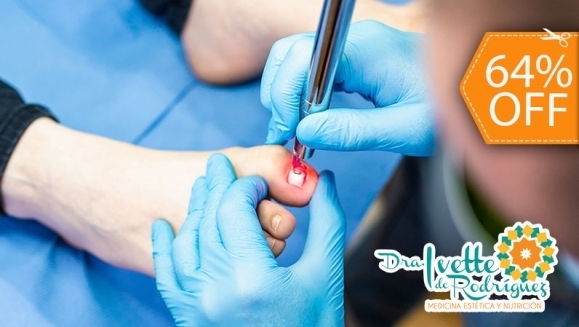 [Image: ¡Paga $18 en Lugar de $50 por 2 Sesiones de Láser para 2 Uñas con Hongos + Evaluación Médica!m]