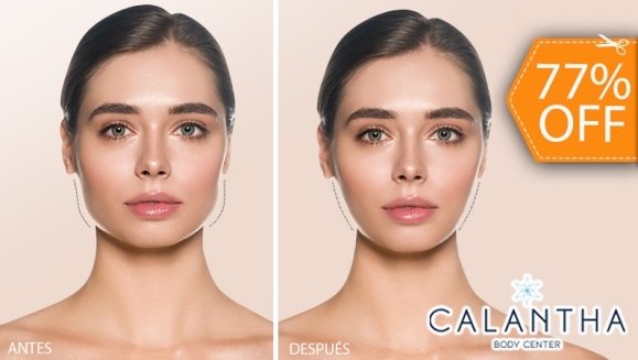 [Image: ¡Paga $99 en Lugar de $430 por 3 Sesiones de Moldeo Facial con Efecto Bichectomía con: 3 Infiltraciones Múltiples con Cóctel de Enzimas + 3 Radiofrecuencias + Evaluación Médica + Membresía Anual!m]