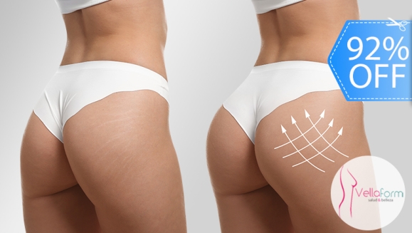 [Image: ¡Levanta esos Glúteos! ¡Paga Q199 en Lugar de Q2,500 por Lifting de Glúteos con 85 Tratamientos de Lipotransferencia + Maderoterapia + Vacumtransfer + Lipolaser + Mesoterapia y Más!m]