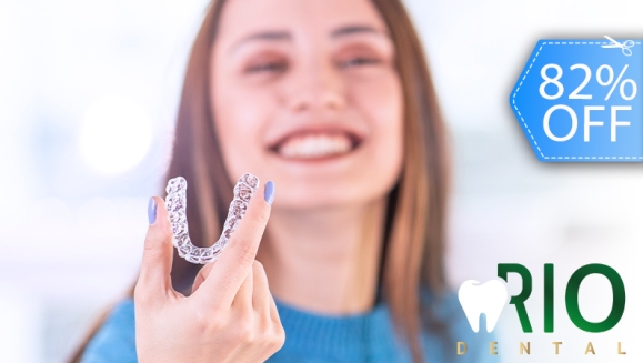 Rio Dental | Guarda Oclusal + Consulta y Evaluación con ...