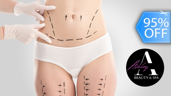 [Image: ¡Paga Q299 en Vez de Q5,700 por 150 Tratamientos de Liporeducción y Lipoescultura con 30 Mesoterapia + 20 Electroreafirmantes + 20 Lipoláser + 10 Ultracavitaciones + 10 Maderoterapias + 20 Geles Termo-activos + 2 Desintoxicaciones Iónicas y Más!m]
