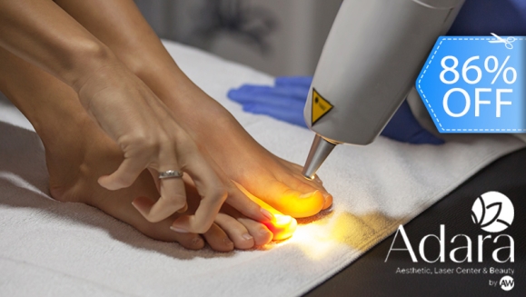 [Image: ¡Paga Q275 en Lugar de Q1,900 por 3 Sesiones Láser en 10 Uñas para Eliminar Hongos + Aplicación de Medicamento Antimicótico!m]