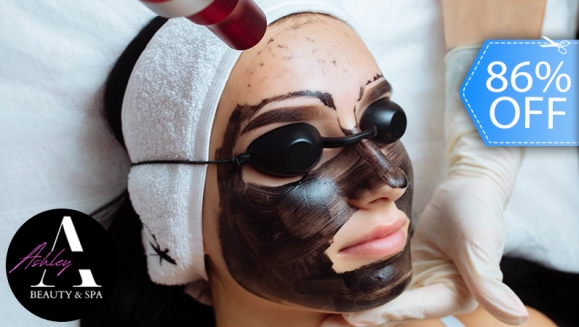 [Image: ¡Paga Q99 en lugar de Q700 por Facial de Rejuvenecimiento “Hollywood Peel” con: Radiofrecuencia Tripolar + Aplicación de Láser + Mascarilla de Carbón Activado + Extracción de Puntos + Exfoliación + Velo de Colágeno!m]