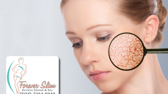 [Image: ¡Paga $45 en lugar de $315 por Paquete Facial de 14 tratamientos: 1 Microdermoabrasión + 3 Limpiezas + 2 Lifting + 2 Exfoliaciones enzimáticas + 2 Mascarillas de Colágeno + 2 Crioterapias + 1 Altafrecuencia + 1 Mascarilla Hidratante en Forever Slim!m]