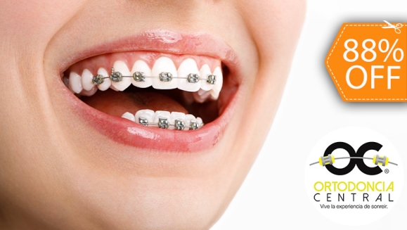 [Image: ¡Paga $49 en Lugar de $420 por Colocación de Brackets Metálicos + Evaluación y Diagnóstico Clínico + Fotografías y Modelo de Estudio + 1 Consulta de Control + 1 Limpieza Dental!m]