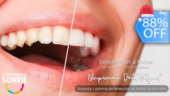 [Image: ¡Paga Q449 en Lugar de Q3,598 por Blanqueamiento Dental con Luz LED + Limpieza Ultrasónica Profunda con Eliminación de Sarro y de Manchas de Colorantes con Pulido Profiject + Sistema de Detección de Bacterias Dentales!m]