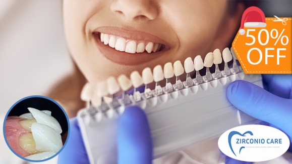 [Image: ¡Paga $62.50 en Lugar de $125 por Carilla Dental de Cerómero + Limpieza Dental con Ultrasonido!m]