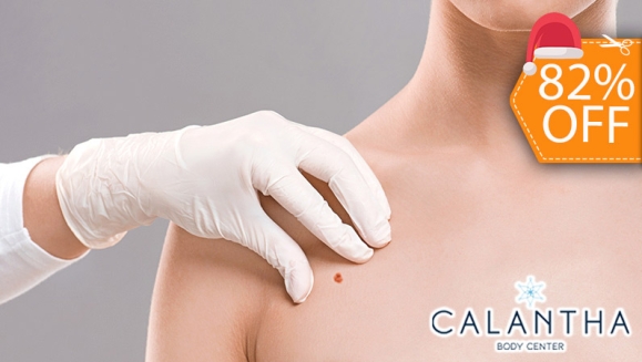 [Image: ¡Paga $18 en Lugar de $100 por Electrocauterización de hasta 20 Verrugas!m]