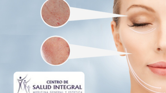 [Image: ¡Paga $40 en lugar de $180 por una sesión de Microdermoabrasión con Limpieza Profunda + 2 sesiones de Miami Peeling + 3 Mascarillas + 3 Altafrecuencias + Evaluación Médica en el Centro de Salud Integral!m]