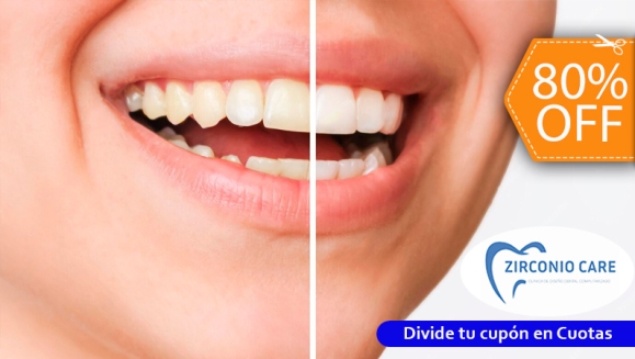 [Image: ¡Paga $50 en Lugar de $250 por Blanqueamiento Dental Químico con Luz LED + Baño de Gel Desensibilizante + Limpieza Profunda con Ultrasonido (Destartraje) + Consulta Odontológica!m]
