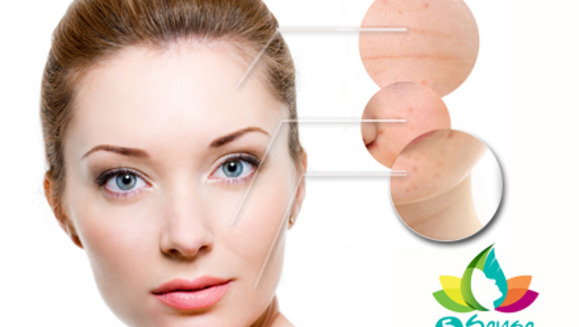 [Image: ¡Paga $18 en lugar de $75 por una sesión de microdermoabrasión con punta de diamante que incluye: Limpieza Facial Profunda + Exfoliación + Extracción de puntos + Alta frecuencia + Mascarilla Hidratante + Masaje facial Relajante en 5 Sense!m]