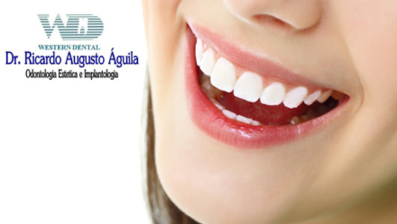 [Image: ¡Paga $32 en lugar de $190 por Diagnóstico Buco-Dental + Limpieza con Ultrasonido + Aplicación de Flúor + 1 Radiografía + 2 Rellenos Estéticos de Resina Blanca o 4 Sellantes de Fosas y Fisuras en la lujosa sala VIP de Western Dental San Benito!m]