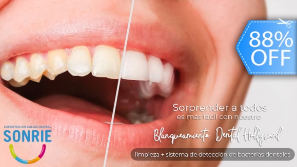 [Image: ¡Paga Q449 en Lugar de Q3,598 por Blanqueamiento Dental Ultra White + Limpieza Ultrasónica Profunda con Eliminación de Sarro y de Manchas de Colorantes con Pulido Profiject + Sistema de Detección de Bacterias Dentales!m]