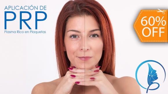 [Image: ¡Paga $180 en Lugar de $450 por 3 Sesiones de Plasma Rico en Plaquetas para Rejuvenecimiento Facial o Calvicie + 3 Limpiezas Faciales con 3 Microdermoabrasiones + 3 Extracciones de Puntos Negros + Consulta Médica!m]