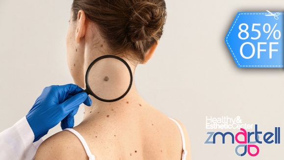 [Image: ¡Paga Q75 en Lugar de Q500 por Cauterización Láser de hasta 10 Cabezas de Vena, 4 Lunares o 4 Verrugas (de hasta 5 mm) + Evaluación Médica!m]