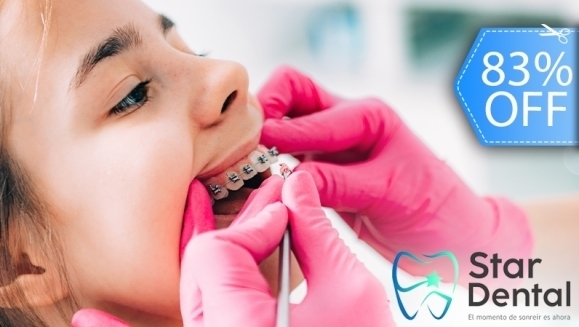 [Image: ¡Paga Q299 en Lugar de Q1,800 por Colocación de Brackets Metálicos (Superiores e Inferiores) + Limpieza con Ultrasonido + Evaluación con Cámara Intraoral y Plan de Tratamiento + Fotografías Dentales!m]