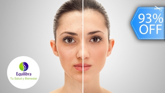 [Image: ¡Paga Q199 en Vez de Q2,800 por Rejuvenecimiento y Relleno Facial para Eliminar Arrugas, Líneas de Expresión y Cicatrices que Incluye: Rellenos con Células Madre, Aplicación de Enzimas Plaquetarias, Estiramiento, Tensado Facial y Más!m]