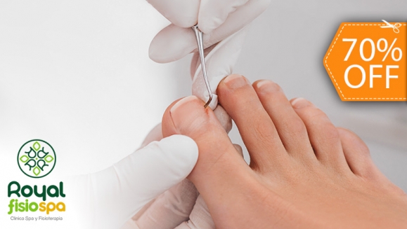 [Image: ¡Paga $9 en Lugar de $30 por Pedicure Clínico + Evaluación Podológica de Uñas y Pies + Uso Instrumental Quirúrgico Esterilizado + 60% de Descuento por 1 Extracción de Uñero!m]