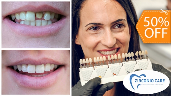 [Image: ¡Mejora la Forma y el Color de tu Sonrisa! ¡Paga $62.50 en Lugar de $125 por Carilla Dental de Cerómero + Limpieza Dental con Ultrasonido!m]