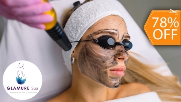 [Image: ¡Adiós Poros Dilatados! ¡Paga $19 en Vez de $85 por Facial de Rejuvenecimiento “Hollywood Peel” con Microdermoabrasión con Punta de Diamante + Aplicación de Láser + Mascarilla de Carbón Activado + Extracción de Puntos Negros + Exfoliación y Más!m]
