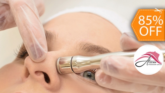 [Image: ¡Paga $20 en Lugar de $130 por 2 Sesiones de Limpieza Facial Profunda con: 2 Microdermoabrasiones con Punta de Diamante + 2 Alta Frecuencias + 2 Limpiezas Faciales con Extracción de Puntos Negros + 2 Sesiones de Vapor de Ozono y Más!m]