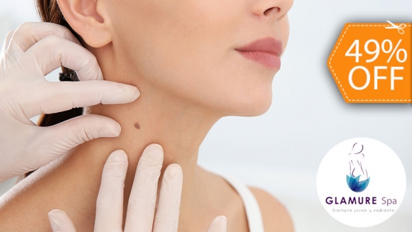 [Image: ¡Paga $18 en Lugar de $35 por Electrocauterización de Hasta 20 Verrugas!m]