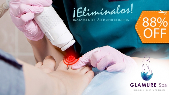 [Image: ¡Paga $10 en Lugar de $80 por 1 Sesión Láser para 2 Uñas con Hongo + Evaluación Médica!m]