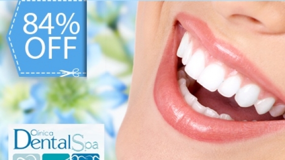 [Image: ¡Paga Q395 en lugar de Q2400 por paquete que incluye: Blaqueamiento Láser + Pulido de Superficies Dentales con Profijet + Limpieza Profunda con Ultrasonido + Examen completo y Evaluación con Cámara Intraoral en Dental Spa!m]