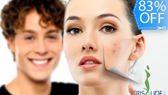 [Image: ¡Paga Q135 en lugar de Q800 por Paquete Facial Anti-Acné ó Anti-Manchas que incluye: Peeling Personalizado + Microdermoabrasión con Punta de Diamante + 2 Altas Frecuencias + 2 Mascarillas Anti-Acné ó Anti-Manchas + 2 Hidrataciones en Crisalide!m]