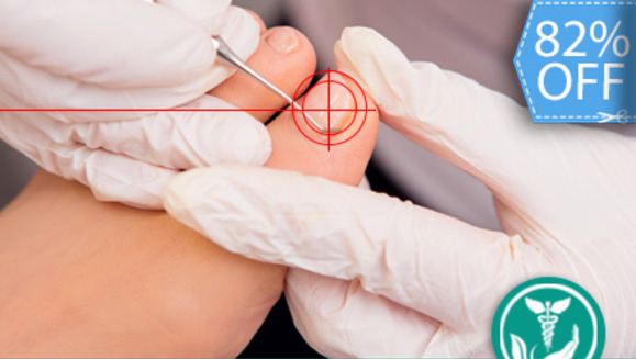 [Image: ¡Libérate de los Hongos en las Uñas!¡Paga Q175 en lugar de Q999 por Tratamiento Láser para Hongos en las Uñas + Examen Diagnóstico + Recomendaciones y Recetas Post Tratamiento en Clínica Biológica!m]