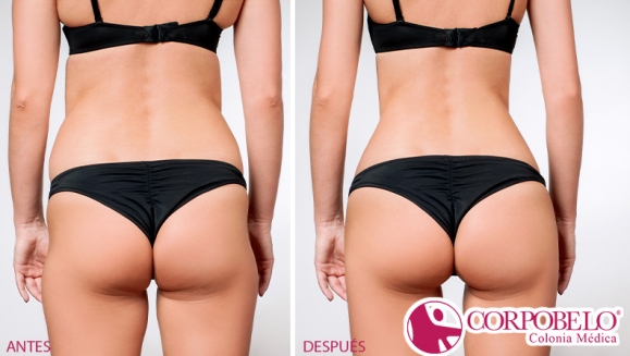 [Image: ¡Paga $24 en Lugar de $200 por 28 Tratamientos para Moldear, Levantar y Tonificar Glúteos: 4 Levantamientos + 4 Rellenos + 4 Redondeos + 4 Tonificadores + 4 Moldeos de Espalda + 4 Moldeos de Cintura + 4 Alisamientos de Piel!m]