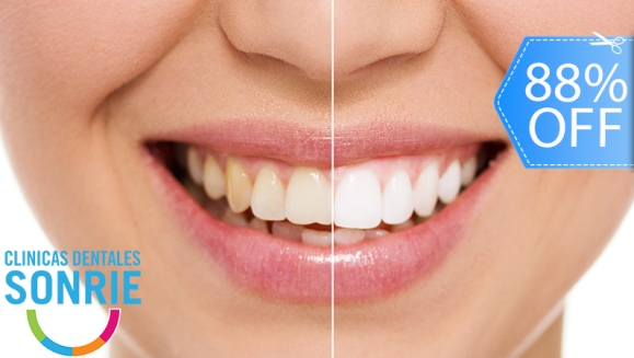 [Image: ¡Paga Q449 en Lugar de Q3,598 por Blanqueamiento Dental con Luz LED + Limpieza Ultrasónica Profunda con Eliminación de Sarro y de Manchas de Colorantes con Pulido Profiject + Diagnóstico Integral Completo con Radiografías y Fotografías Digitales!m]