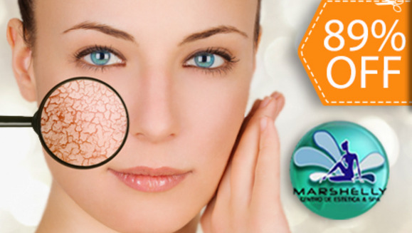 [Image: ¡Paga $49 en vez de $465 por 1 Microdermoabrasión con punta de diamante + Inyectaje de Ácido Hiáluronico + 1 Mallado de Colágeno y más en Marshelly!m]