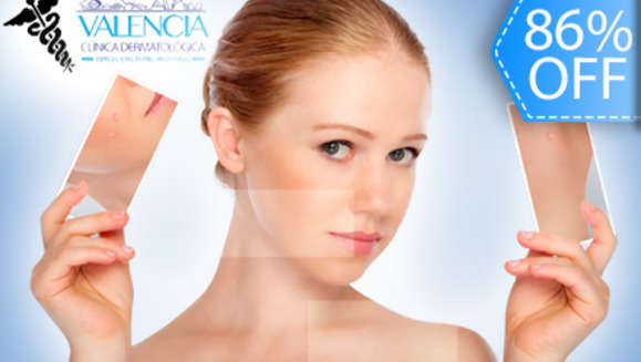 [Image: ¡Paga Q195 en vez de Q1,400 por Paquete Facial Anti Acné de 11 Tratamientos que incluye: 2 Microdermoabrasiones + 1 Peeling + 1 Sesión de Luz LED y  Mucho Más en Valencia Clínica Dermatológica!m]