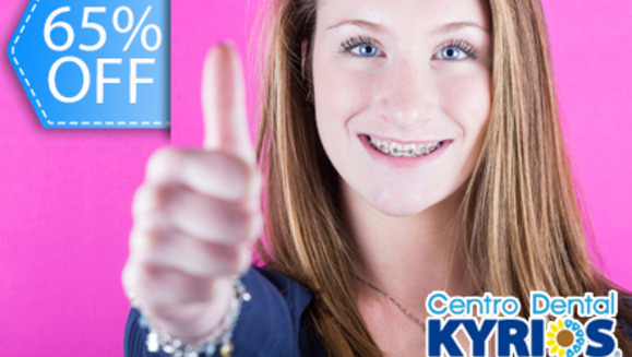 [Image: ¡Paga Q695 en lugar de Q1,980 por Colocación de Brackets Metálicos + Profilaxis + Eliminación de Sarro + Evaluación + Aplicación de Flúor en Centro Dental Kyrios!m]