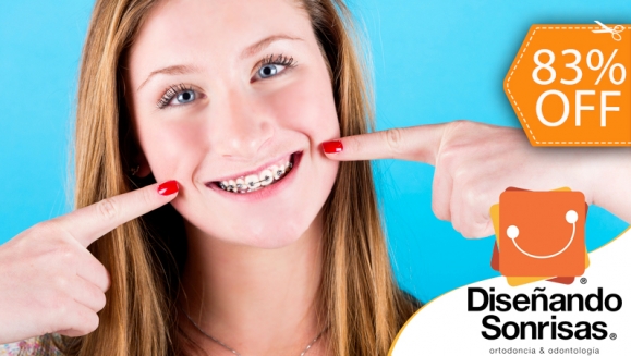 [Image: ¿Quieres tus dientes alineados? ¡Paga $95 en vez de $550 por Colocación de Mini-Brackets Metálicos en Diseñando Sonrisas!m]