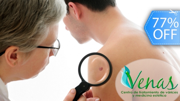 [Image: ¡Paga Q149 en vez de Q650 por Eliminación Láser de Hasta 5 Lunares, Cabezas de Vena o Arañitas Faciales + Evaluación Profesional en Venas Guatemala!m]