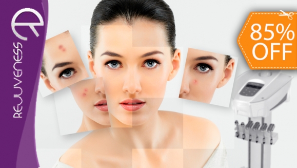 [Image: ¡Paga $90 en lugar de $590 por Tratamiento Facial contra Acné, Manchas y Envejecimiento que Incluye: 4 Limpiezas Especializadas, 4 Sesiones de Luz Led con DERMAMAX Y 4 Tratamientos para Cicatrizar Brotes Inflamados en Rejuveness Center!m]