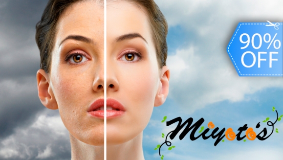 [Image: ¡Paga Q275 en lugar de Q2,800 por Limpieza Facial Profunda + 4 Sesiones de Microdermoabrasión + 4 Alta Frecuencias + 4 Terapias de Luz Led + 4 Mascarillas + 4 Aplicaciones de Bloqueador Solar + Masaje Cráneo Facial en Miyotos!m]