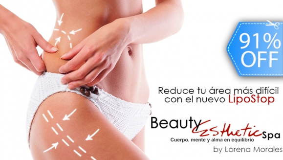 [Image: ¡Paga Q599 en lugar Q6,500 por Paquete Reductivo LipoStop que Incluye: 4 Masajes Reductores + 3 Lipoláser + 3 Power Plate + 3 Algasculptor + 3 Masajes Drenantes Linfáticos + 4 Ozonoterapias + Supervisión Nutricional y Más en Beauty Esthetic.m]