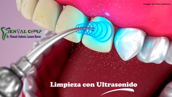 [Image: ¡Paga $25 en Lugar de $180 por 3 Rellenos de Resina o 4 Sellantes + Radiografía + Limpieza Dental con Ultrasonido + Aplicación de Flúor + Consulta y Diagnóstico Bucodental con Cámara Intraoral + Evaluación de Cordales!m]