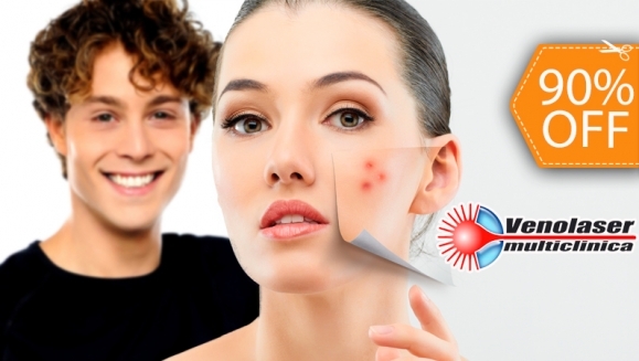 [Image: ¡Paga $99 en lugar de $950 por 4 Sesiones de Láser Anti-Acné + 4 Faciales en Venolaser!m]