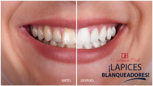 [Image: ¡Paga Q130 en Lugar de Q285 por 3 Lápices Blanqueadores de Dientes!m]