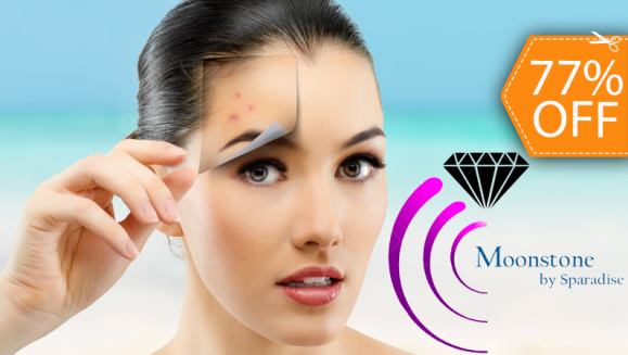 [Image: ¡Paga $22 en lugar de $95 por 2 Microdermoabrasiones con Punta de Diamante + 2 Limpiezas Faciales Profundas + 2 Vaporizaciones + 2 Extracciones de Puntos Negros + 2 Altafrecuencias + 2 Aplicaciones de Velo de Colágeno en Moonstone by Sparadise!m]