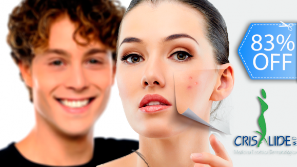 [Image: ¡Paga Q135 en lugar de Q800 por Paquete Facial Anti-Acné o Anti-Manchas que Incluye: Peeling Personalizado + Microdermoabrasión con Punta de Diamante + 2 Alta Frecuencias + 2 Mascarillas Anti-Acné + 2 Hidrataciones en Crisalide!m]