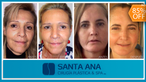 [Image: ¡Paga $200 en lugar de $1,350 por 3 Sesiones de Plasma Rico en Plaquetas para Rejuvenecimiento del Rostro en Santa Ana Cirugía Plástica &amp; Spa!m]