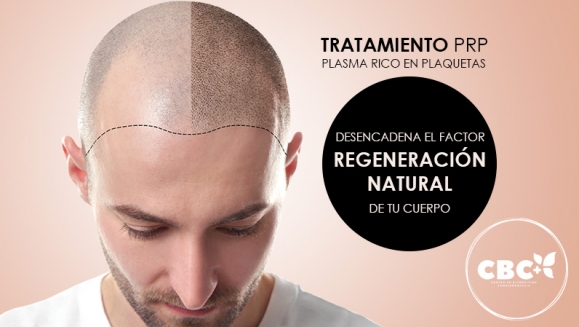 [Image: ¡Paga $199 en Lugar de $740 por 3 Sesiones de Plasma Rico en Plaquetas para Calvicie o Rejuvenecimiento Facial + 3 Limpiezas de Rostro + 3 Mascarillas de Ozono o Carbón Activado + 3 Microneedling + 6 Mascarillas Vampiro con Colágeno Puro y Más!m]