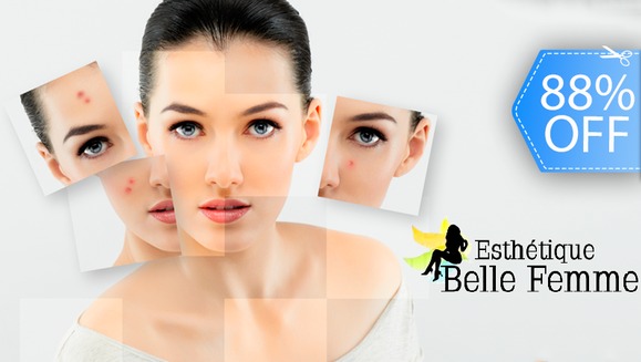 [Image: ¡Paga Q99 en lugar de Q800 por Facial de Limpieza Profunda con Exfoliación + Alta Frecuencia + Energía Galvánica + Hidratación + Extracción de Puntos Negros + Vaporización + Peeling Personalizado + Aromaterapia en Esthetique Belle Femme!m]