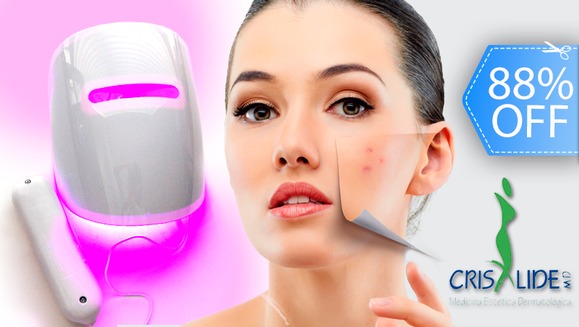 [Image: ¡Paga Q199 en lugar de Q1,600 por 2 Sesiones de Fototerapia LED (Anti-Acne, Anti-Aging o Anti Manchas) + 2 Mascarillas Personalizadas + Examen Diagnóstico Profesional en Crisalide!m]